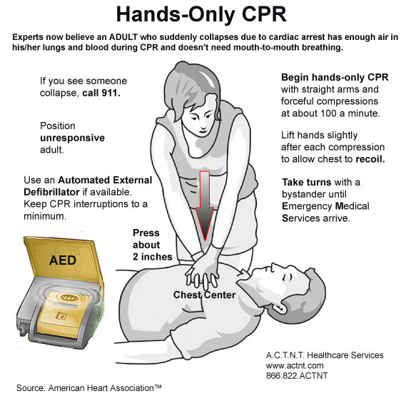 Cpr перевод. Hands only CPR. CPR.